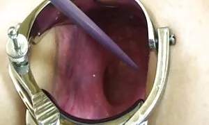 Exciting mi first ex ...